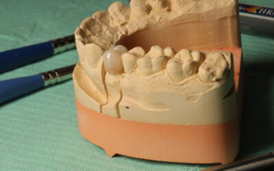 Quick Facts from a Shelburne Dentist Regarding Dental Crowns & Restorative Dentistry