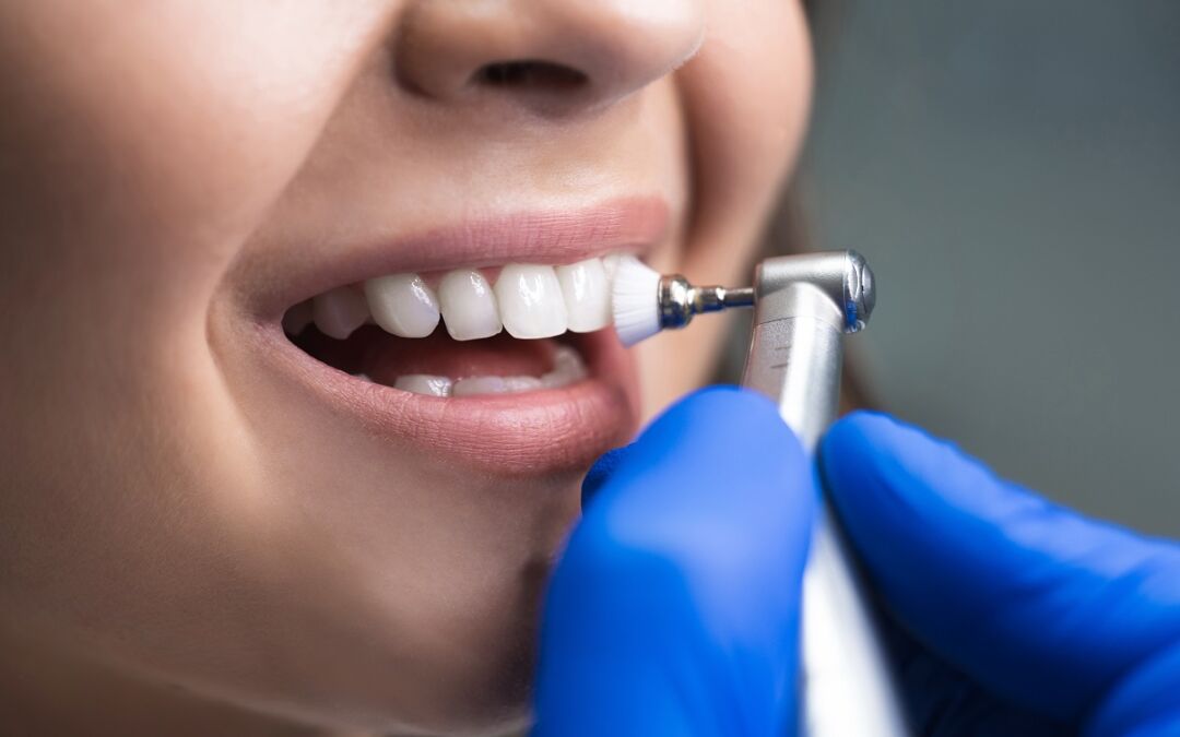 Dental Teeth Cleaning