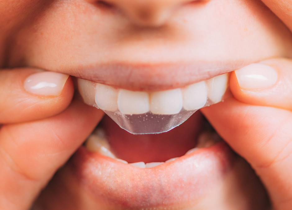 Teeth Whitening Strips