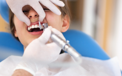 Can Dental Cleanings Damage Your Teeth?