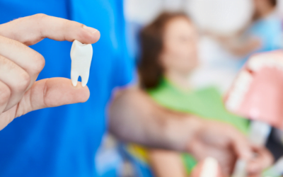 What to Eat After a Tooth Extraction