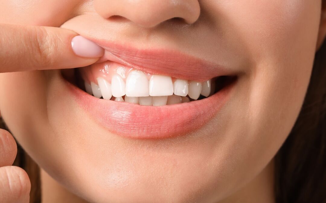 How To Keep Gums Healthy