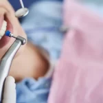 Professional Dental Cleaning