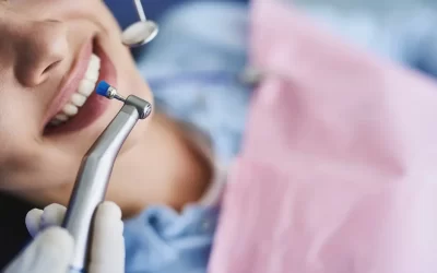 5 Reasons Why Professional Dental Cleaning Should Be On Your List