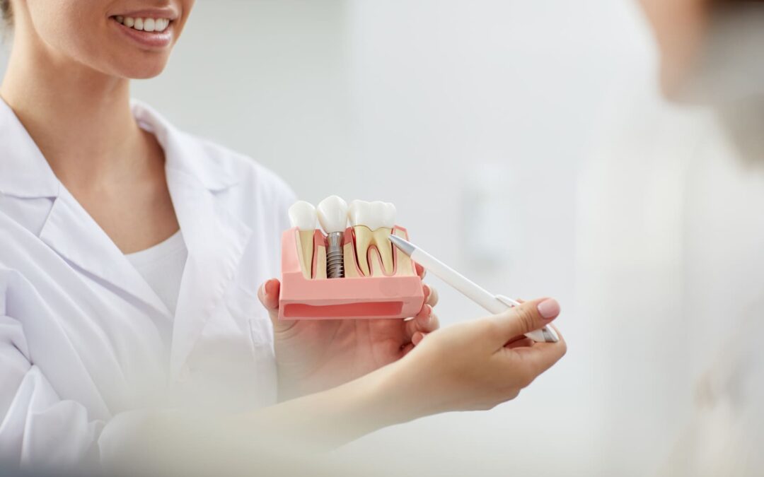Dental Implant Process