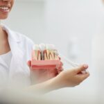 Dental Implant Process