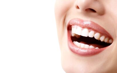 DIY Teeth Whitening Gimmicks: Which Products to Avoid and Why Professional Whitening is Safer