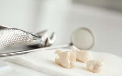Tooth Extraction Can Be Easier Than You Think