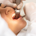 family dentist shelburne