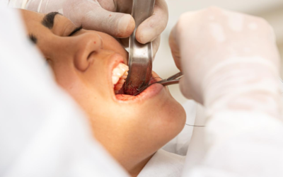 Why older dental fillings wear out over time and how to recognize when they need to be updated?