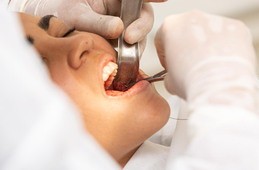 Why older dental fillings wear out over time and how to recognize when they need to be updated?